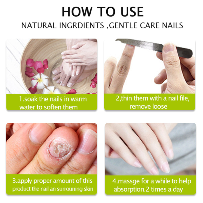 Nail Repair Treatment Gel